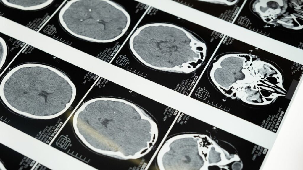 Analyse d'échantillon en laboratoire de toxicologie