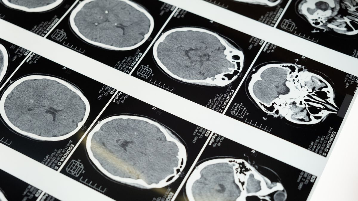 Analyse d'échantillon en laboratoire de toxicologie