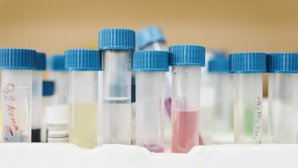Analyse d'échantillon en laboratoire de toxicologie