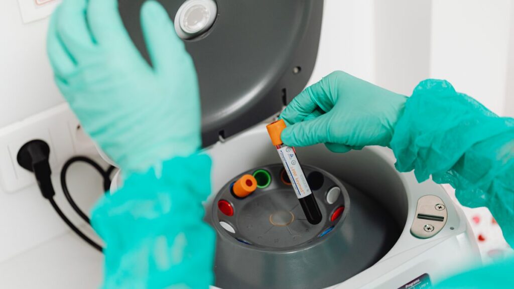 Contrôle qualité d'un test de dépistage en laboratoire