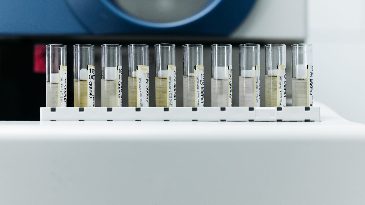 Contrôle qualité d'un test de dépistage en laboratoire