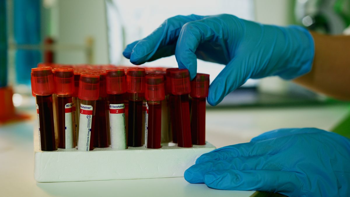 Contrôle qualité d'un test de dépistage en laboratoire