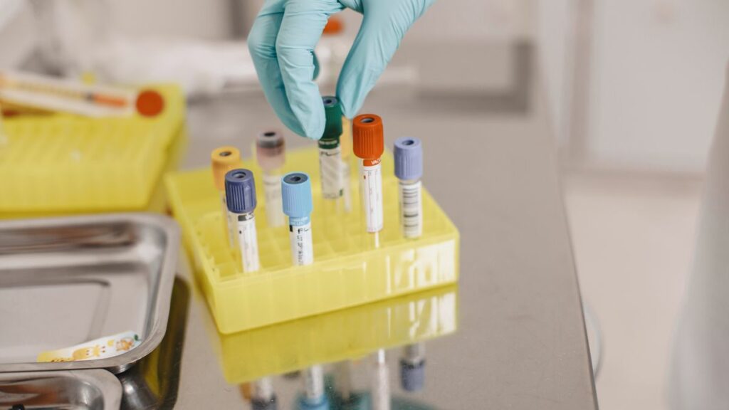 Contrôle qualité d'un test de dépistage en laboratoire