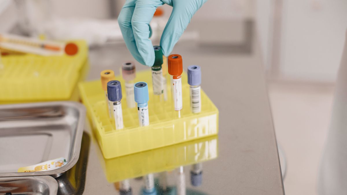 Contrôle qualité d'un test de dépistage en laboratoire
