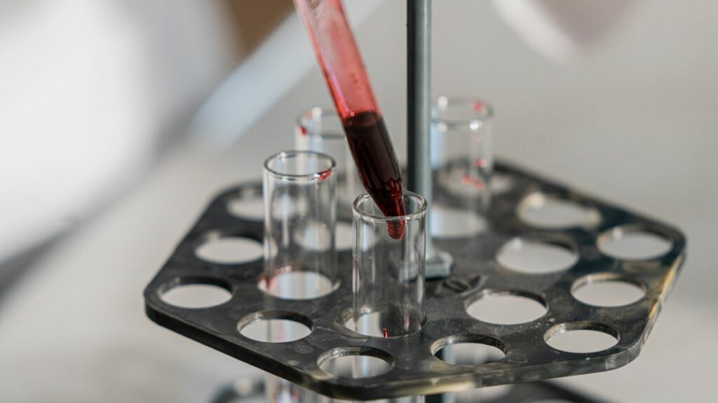 Contrôle qualité d'un test de dépistage en laboratoire