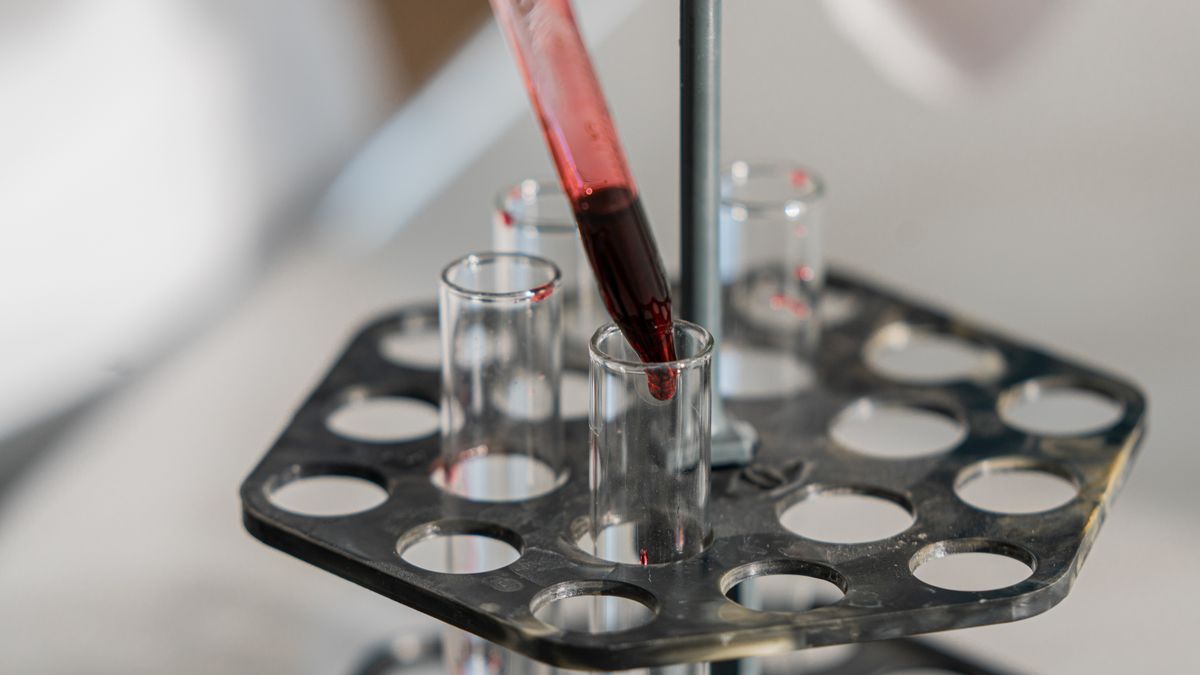 Contrôle qualité d'un test de dépistage en laboratoire