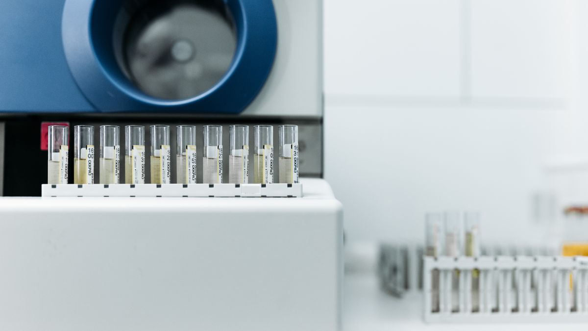 Test urinaire de dépistage de drogues en laboratoire