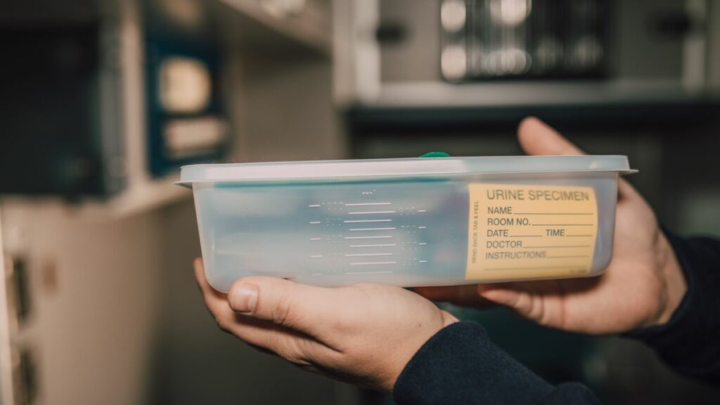Test urinaire de dépistage de drogues en laboratoire