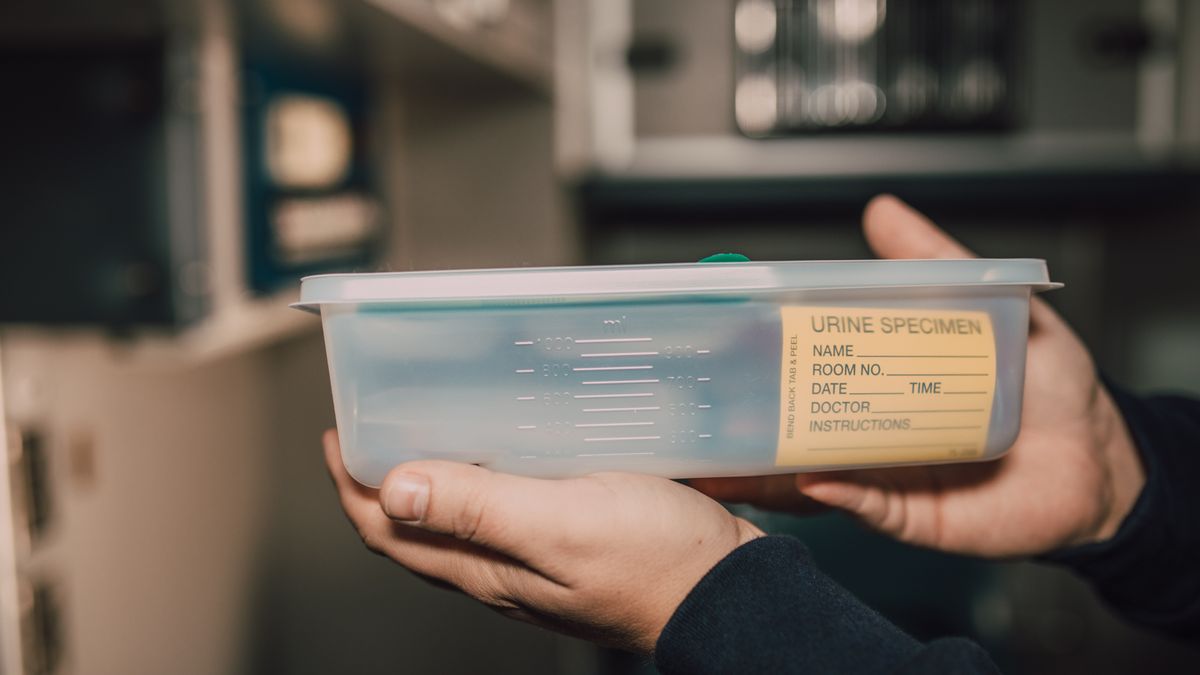 Test urinaire de dépistage de drogues en laboratoire