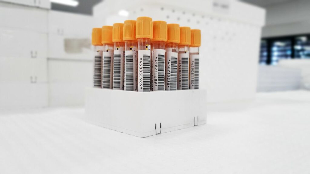 Test urinaire de dépistage de drogues en laboratoire