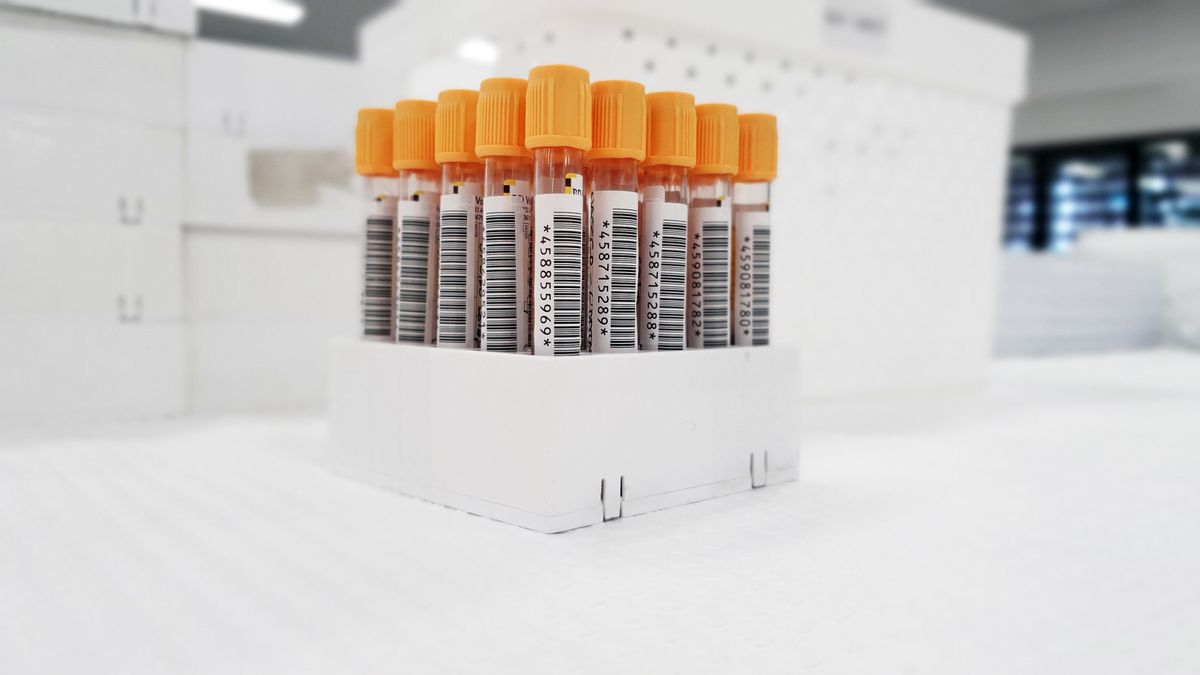 Test urinaire de dépistage de drogues en laboratoire